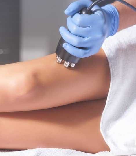 Cavitation
